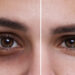 augenringe in 1 minute weg